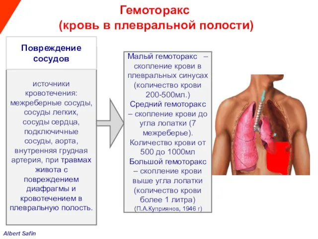 Albert Safin Гемоторакс (кровь в плевральной полости) источники кровотечения: межреберные сосуды,