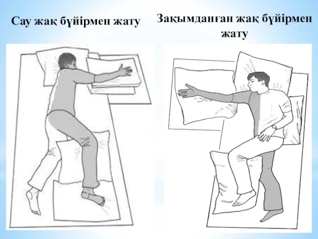 Сау жақ бүйірмен жату Зақымданған жақ бүйірмен жату