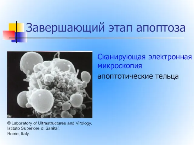 Завершающий этап апоптоза Сканирующая электронная микроскопия апоптотические тельца © Laboratory of