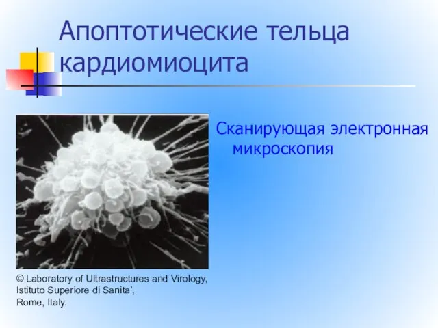 Апоптотические тельца кардиомиоцита © Laboratory of Ultrastructures and Virology, Istituto Superiore