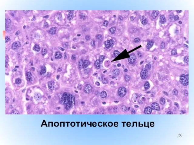 Апоптотическое тельце