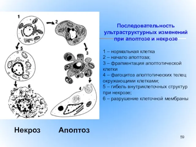 Последовательность ультраструктурных изменений при апоптозе и некрозе 1 – нормальная клетка