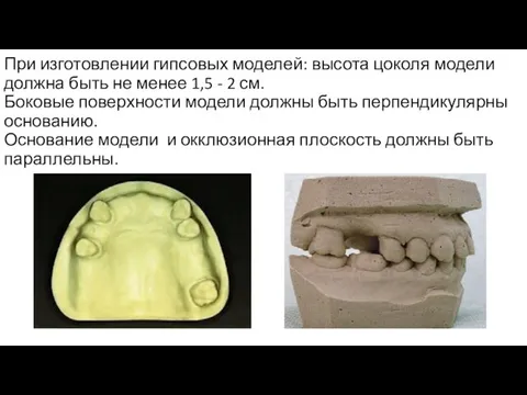 При изготовлении гипсовых моделей: высота цоколя модели должна быть не менее