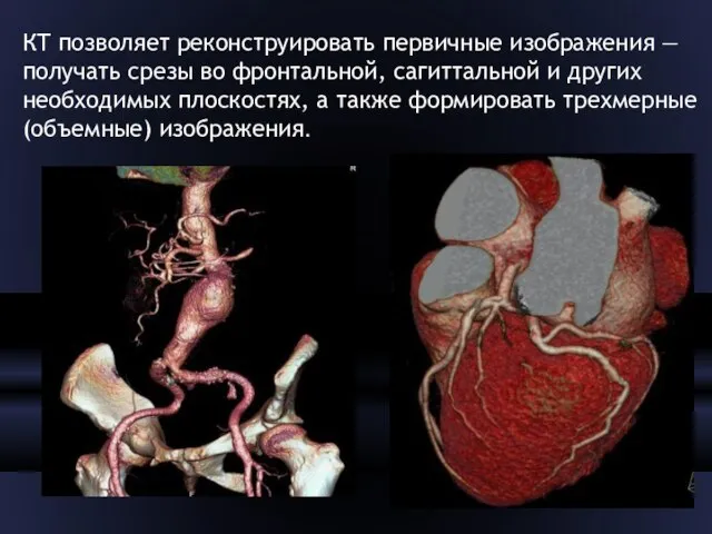 КТ позволяет реконструировать первичные изображения — получать срезы во фронтальной, сагиттальной