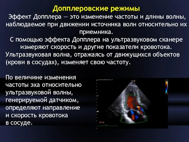 Допплеровские режимы Эффект Допплера — это изменение частоты и длины волны,