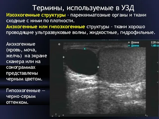 Термины, используемые в УЗД Изоэхогенные структуры – паренхиматозные органы и ткани