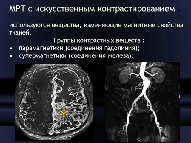 МРТ с искусственным контрастированием – используются вещества, изменяющие магнитные свойства тканей.