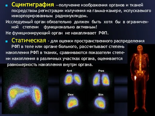 Сцинтиграфия —получение изображения органов и тканей посредством регистрации излучения на гамма-камере,