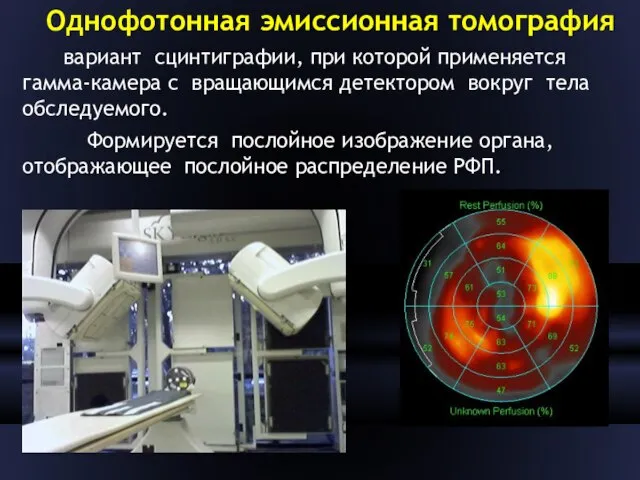Однофотонная эмиссионная томография вариант сцинтиграфии, при которой применяется гамма-камера с вращающимся