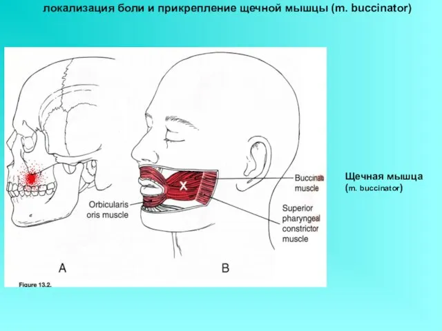Щечная мышца (m. buccinator) локализация боли и прикрепление щечной мышцы (m. buccinator)