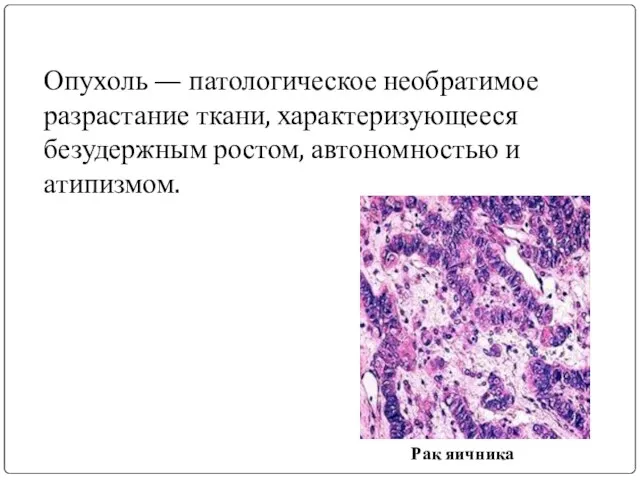 Опухоль — патологическое необратимое разрастание ткани, характеризующееся безудержным ростом, автономностью и атипизмом. Рак яичника