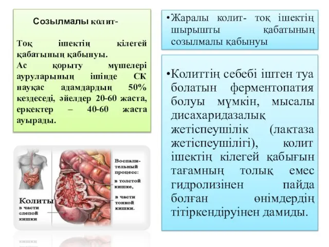 Созылмалы колит- Тоқ ішектің кілегей қабатының қабынуы. Ас қорыту мүшелері ауруларының