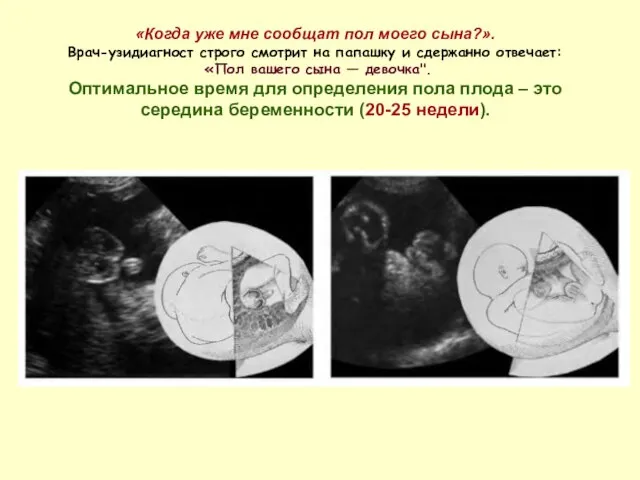 «Когда уже мне сообщат пол моего сына?». Врач-узидиагност строго смотрит на