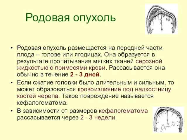 Родовая опухоль Родовая опухоль размещается на передней части плода – голове