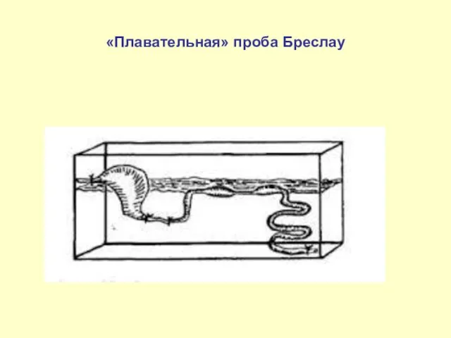 «Плавательная» проба Бреслау