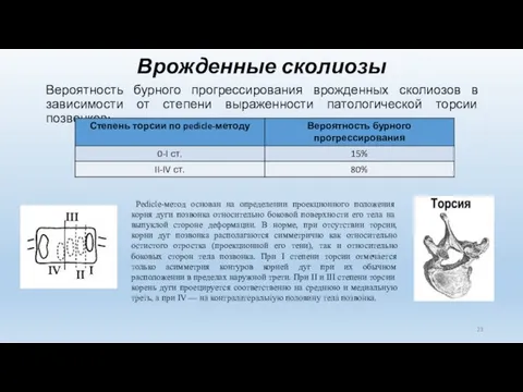 Врожденные сколиозы Вероятность бурного прогрессирования врожденных сколиозов в зависимости от степени