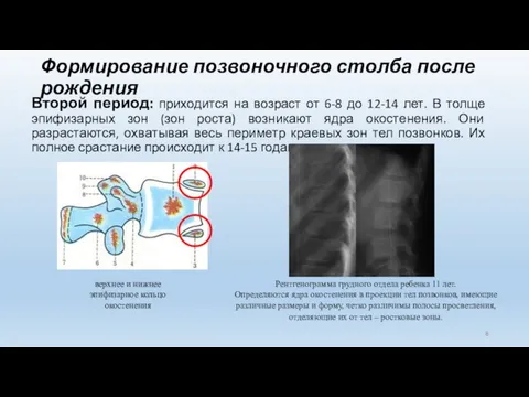 Формирование позвоночного столба после рождения Второй период: приходится на возраст от