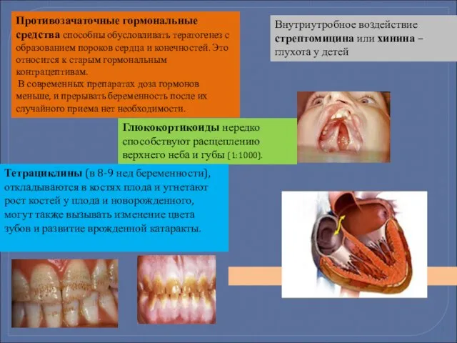 Противозачаточные гормональные средства способны обусловливать тератогенез с образованием пороков сердца и