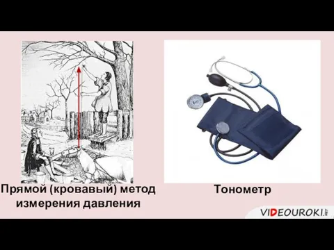 Прямой (кровавый) метод измерения давления Тонометр