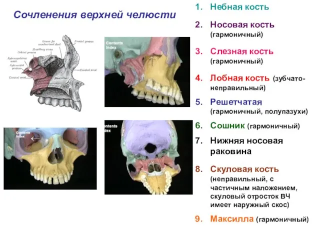 Сочленения верхней челюсти Небная кость Носовая кость (гармоничный) Слезная кость (гармоничный)