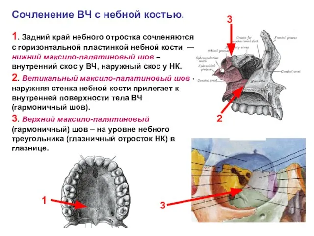 Сочленение ВЧ с небной костью. 1. Задний край небного отростка сочленяются