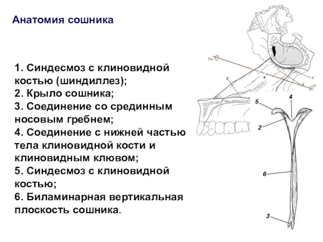 1. Синдесмоз с клиновидной костью (шиндиллез); 2. Крыло сошника; 3. Соединение