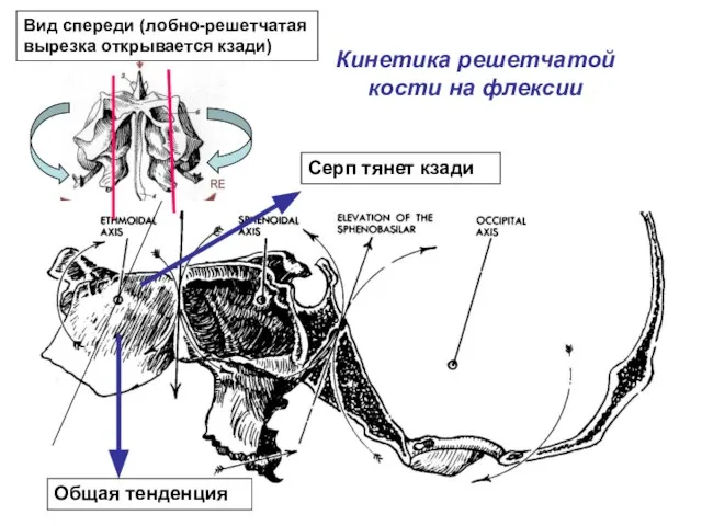 Кинетика решетчатой кости на флексии Серп тянет кзади Общая тенденция Вид спереди (лобно-решетчатая вырезка открывается кзади)