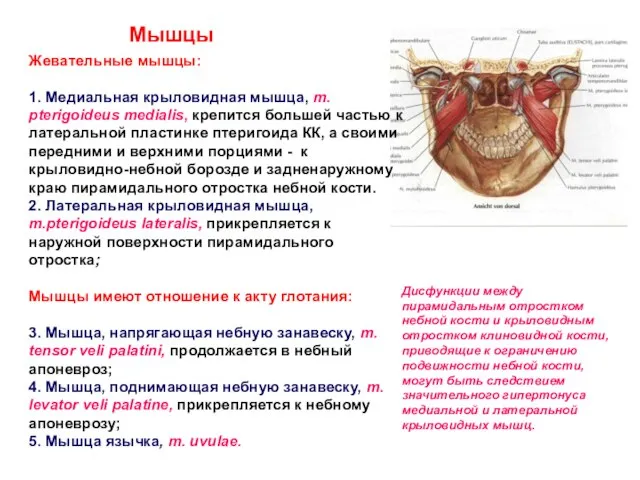 Жевательные мышцы: 1. Медиальная крыловидная мышца, m. pterigoideus medialis, крепится большей