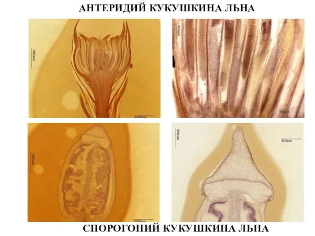 АНТЕРИДИЙ КУКУШКИНА ЛЬНА СПОРОГОНИЙ КУКУШКИНА ЛЬНА