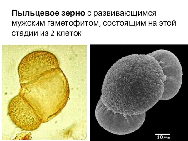 Пыльцевое зерно с развивающимся мужским гаметофитом, состоящим на этой стадии из 2 клеток