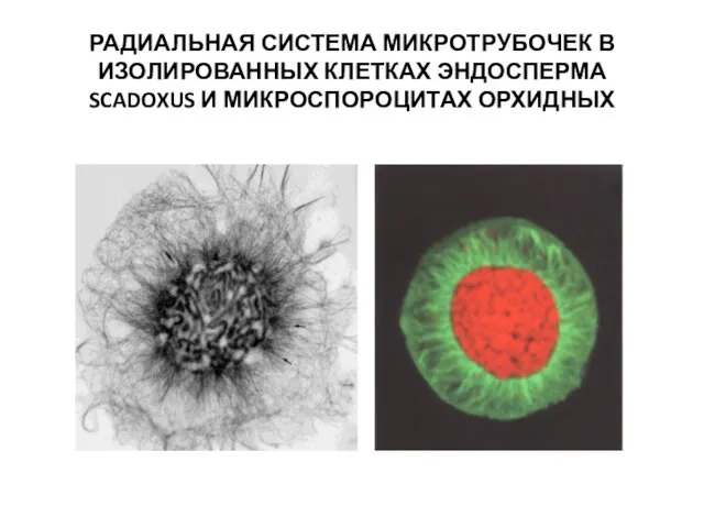 РАДИАЛЬНАЯ СИСТЕМА МИКРОТРУБОЧЕК В ИЗОЛИРОВАННЫХ КЛЕТКАХ ЭНДОСПЕРМА SCADOXUS И МИКРОСПОРОЦИТАХ ОРХИДНЫХ