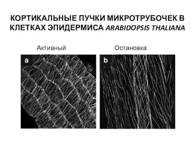 КОРТИКАЛЬНЫЕ ПУЧКИ МИКРОТРУБОЧЕК В КЛЕТКАХ ЭПИДЕРМИСА ARABIDOPSIS THALIANA Активный рост Остановка роста