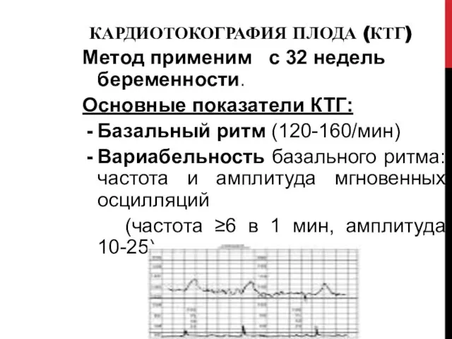 КАРДИОТОКОГРАФИЯ ПЛОДА (КТГ) Метод применим с 32 недель беременности. Основные показатели