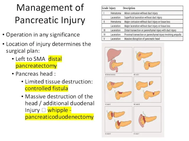 Management of Pancreatic Injury Operation in any significance Location of injury