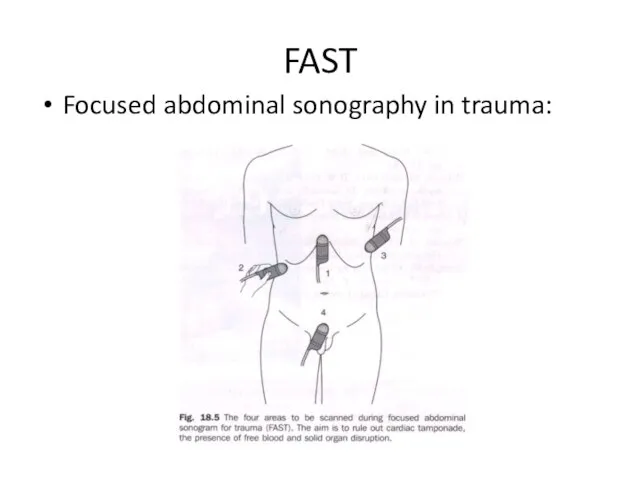 FAST Focused abdominal sonography in trauma: