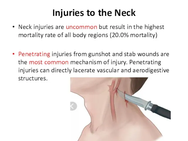 Injuries to the Neck Neck injuries are uncommon but result in