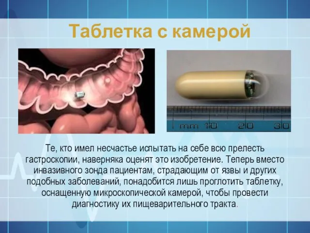 Таблетка с камерой Те, кто имел несчастье испытать на себе всю