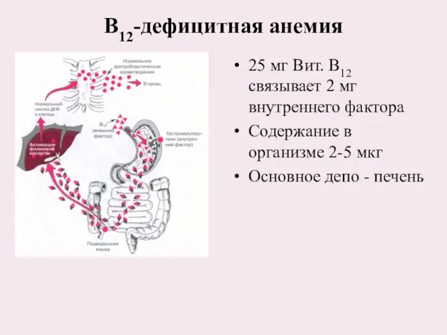 В12-дефицитная анемия 25 мг Вит. В12 связывает 2 мг внутреннего фактора