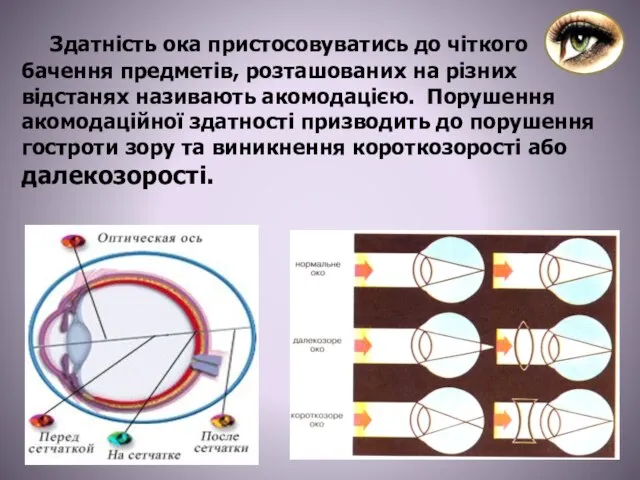 Здатність ока пристосовуватись до чіткого бачення предметів, розташованих на різних відстанях