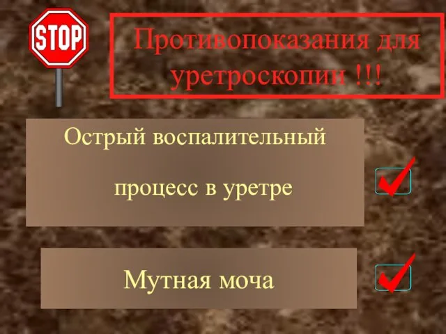 Противопоказания для уретроскопии !!! Острый воспалительный процесс в уретре Мутная моча