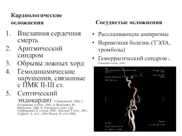 Кардиологические осложнения Сосудистые осложнения Внезапная сердечная смерть Аритмический синдром Обрывы ложных