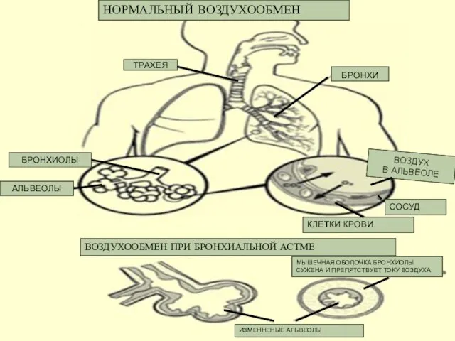 ТРАХЕЯ БРОНХИ БРОНХИОЛЫ АЛЬВЕОЛЫ ВОЗДУХ В АЛЬВЕОЛЕ КЛЕТКИ КРОВИ СОСУД НОРМАЛЬНЫЙ