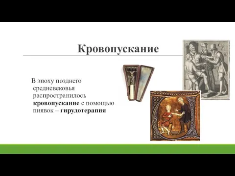 Кровопускание В эпоху позднего средневековья распространилось кровопускание с помощью пиявок – гирудотерапия