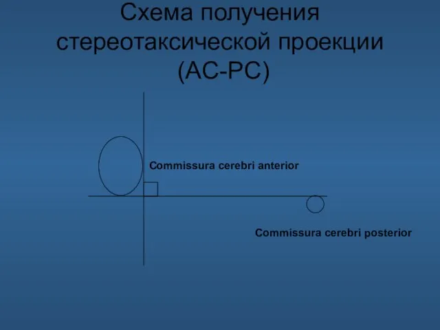 Схема получения стереотаксической проекции (AC-PC) Commissura cerebri anterior Commissura cerebri posterior