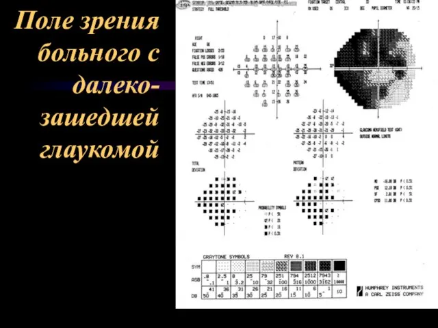 Поле зрения больного с далеко- зашедшей глаукомой