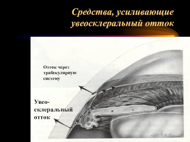 Средства, усиливающие увеосклеральный отток