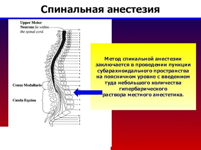 Спинальная анестезия Метод спинальной анестезии заключается в проведении пункции субарахноидального пространства