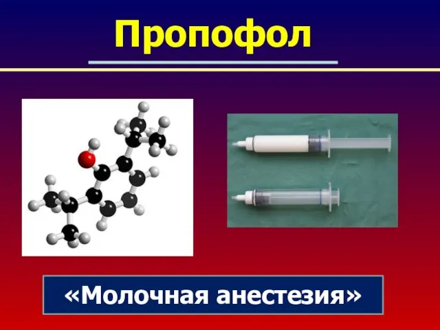 Пропофол «Молочная анестезия»