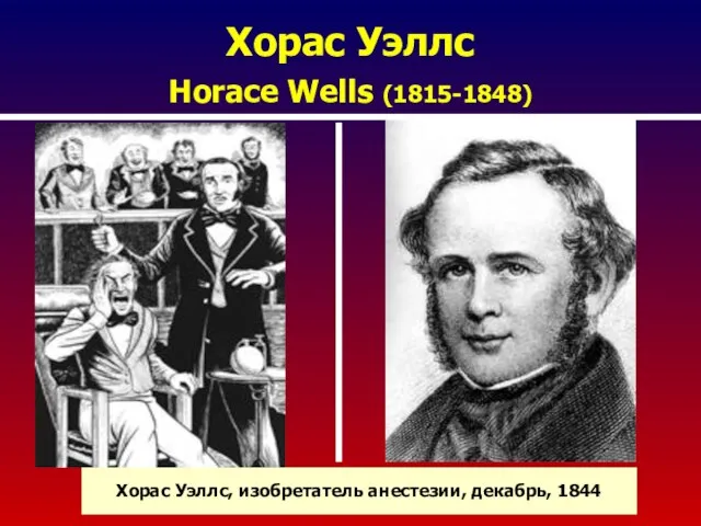 Хорас Уэллс Horace Wells (1815-1848) Хорас Уэллс, изобретатель анестезии, декабрь, 1844