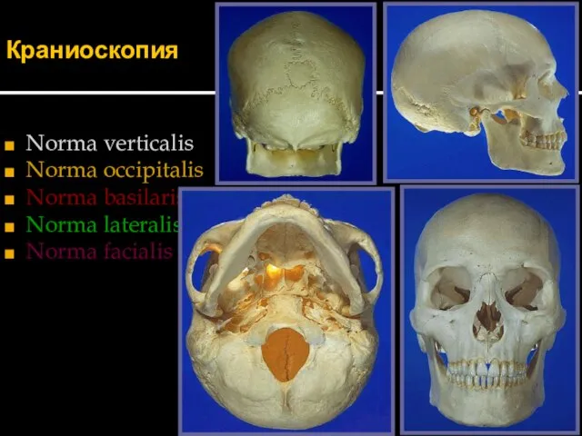 Краниоскопия Norma verticalis Norma occipitalis Norma basilaris Norma lateralis Norma facialis